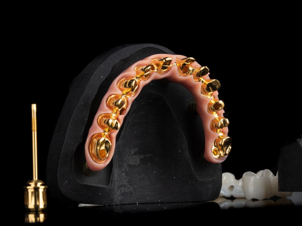 denti fissi arcata gold